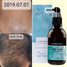 바로티나 뉴헤어토닉 탈모영양제 정수리 탈모고민 기능성 앰플 M자 모발 두피스케일 24주 임상완료, 1개