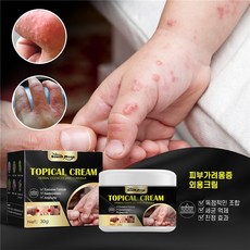 피부가려움증 외용크림 한포진 지루성피부염 습진연고 여드름 모낭염연고, 30g, 1개